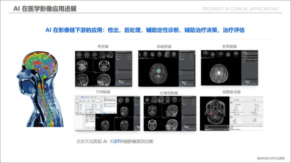 AI在医疗影像领域的突破性进展与应用前景